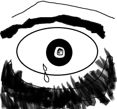 Dave’s Black Eye